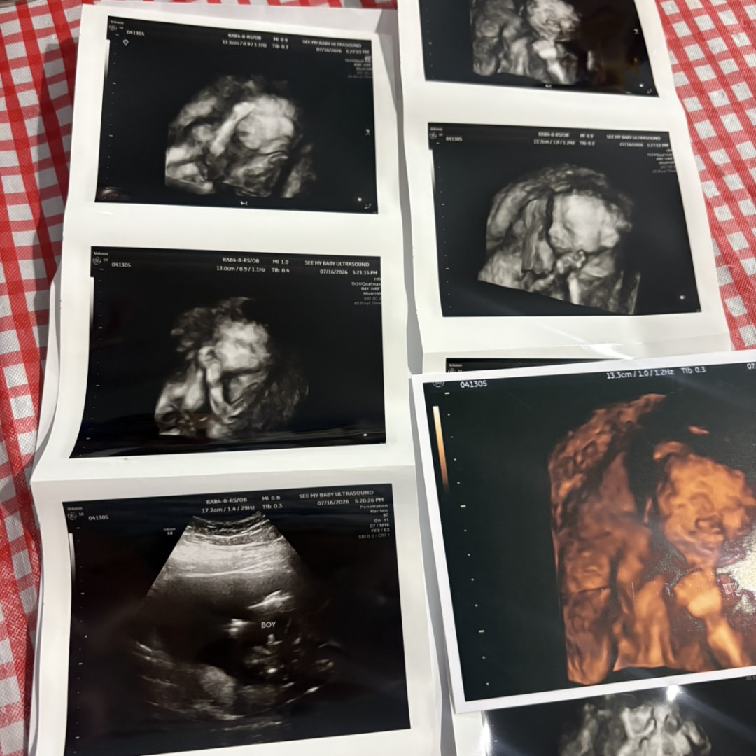 Photo shared by Stephanie for their Babylist baby registry.