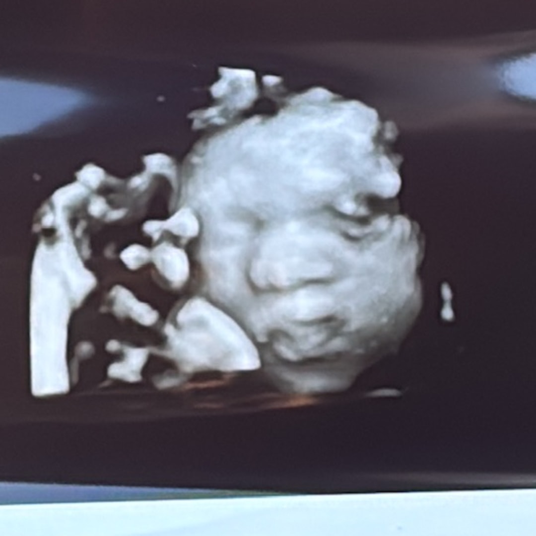 Photo shared by Gina for their Babylist baby registry.