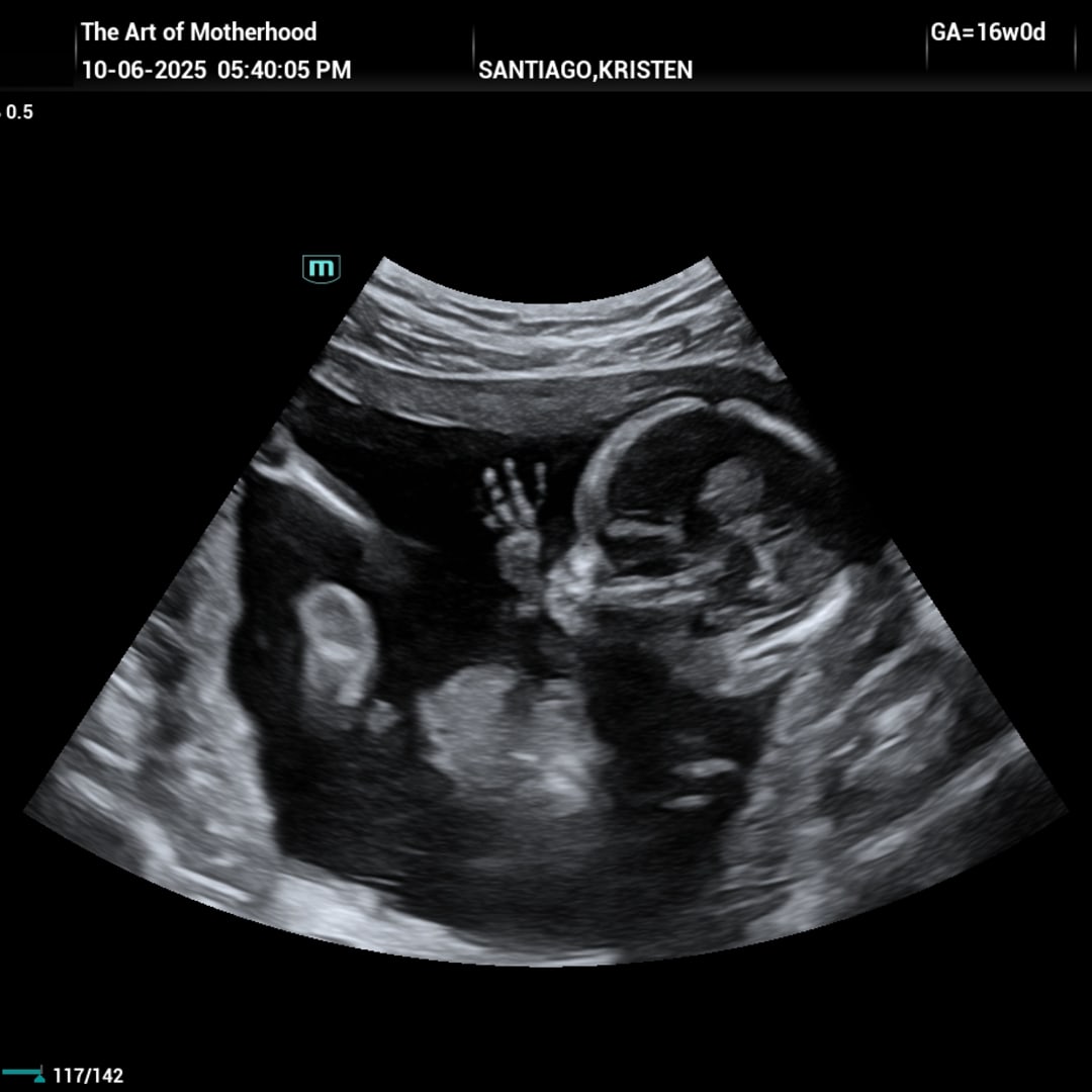 Photo shared by Kristen for their Babylist baby registry.