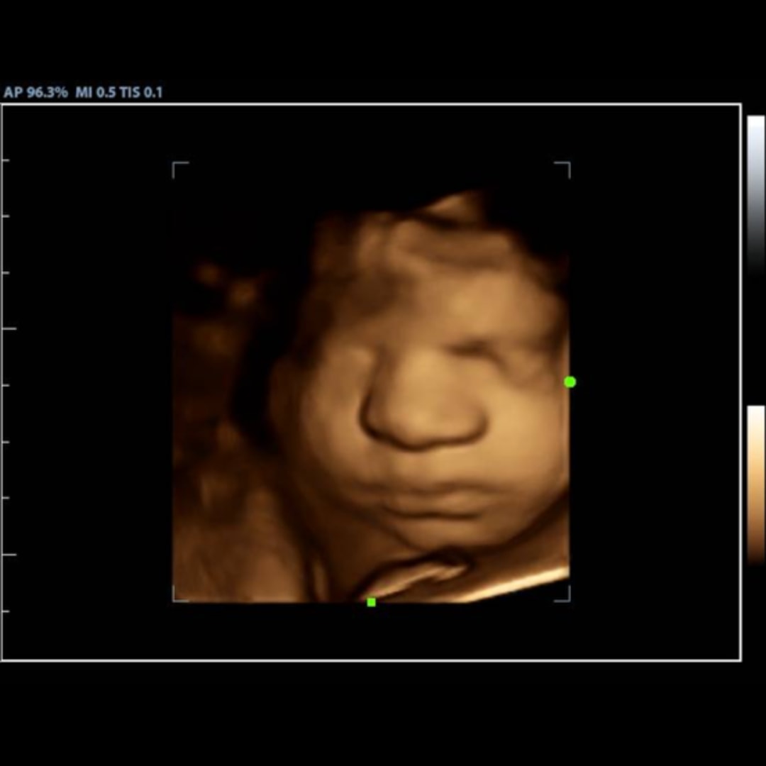 Photo shared by Chloe for their Babylist baby registry.