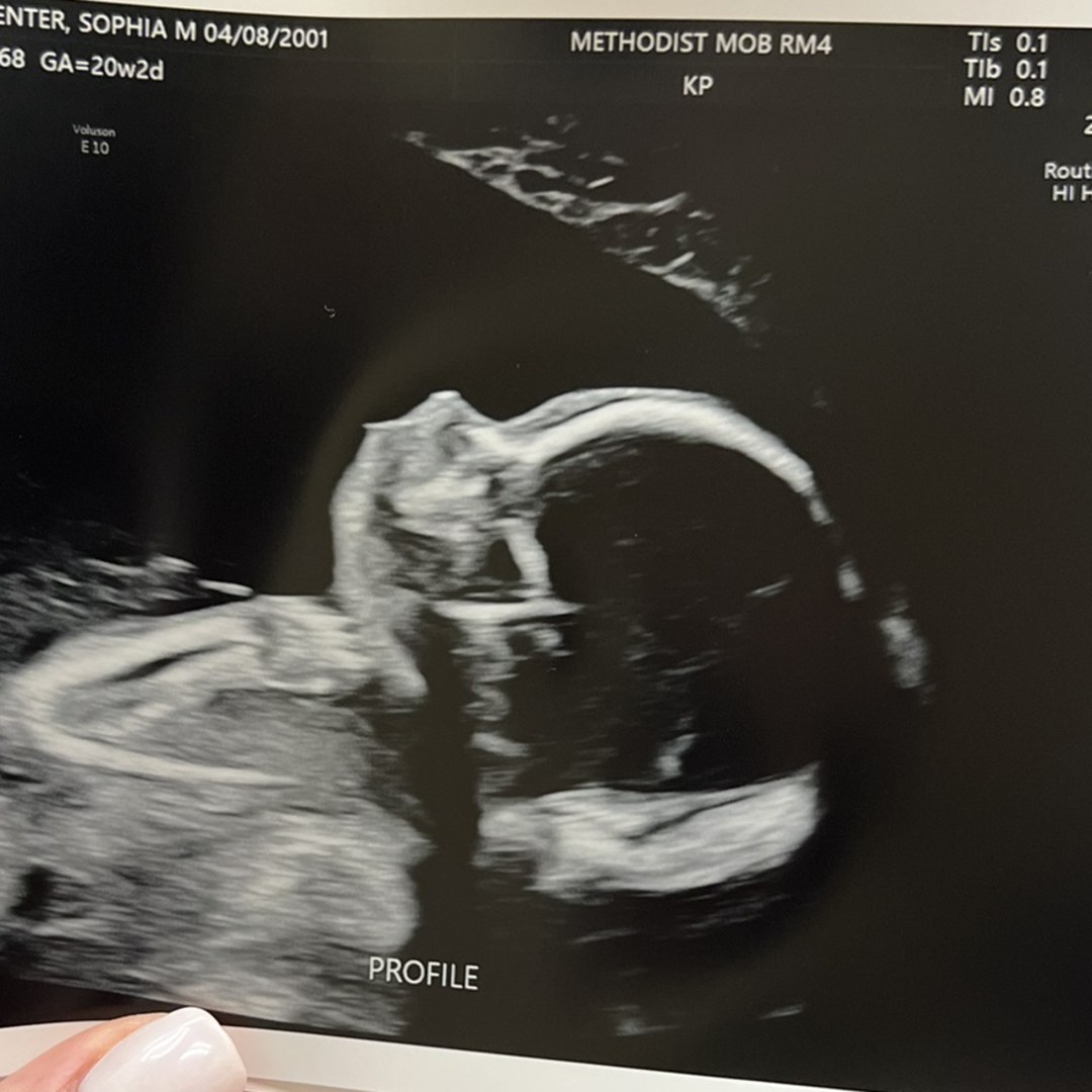 Photo shared by Sophie for their Babylist baby registry.
