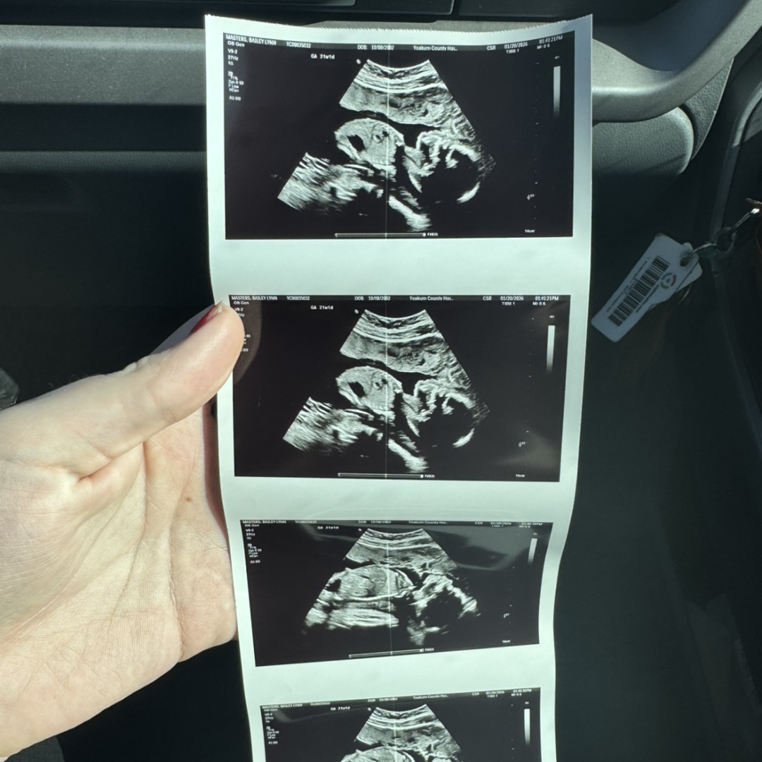 Photo shared by Bailey for their Babylist baby registry.