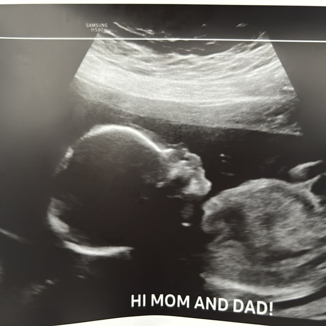 Photo shared by Katie for their Babylist baby registry.