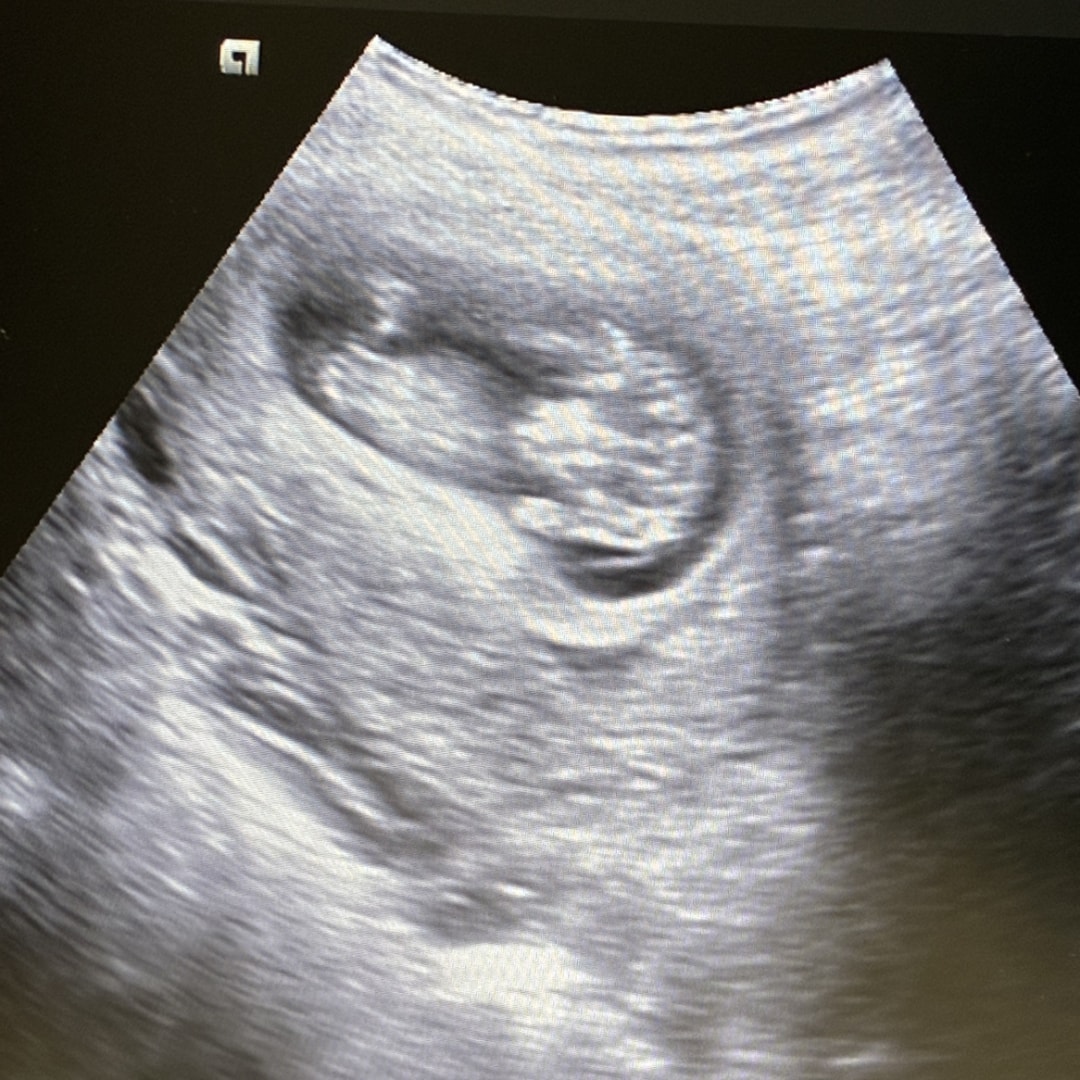 Photo shared by Maddie for their Babylist baby registry.