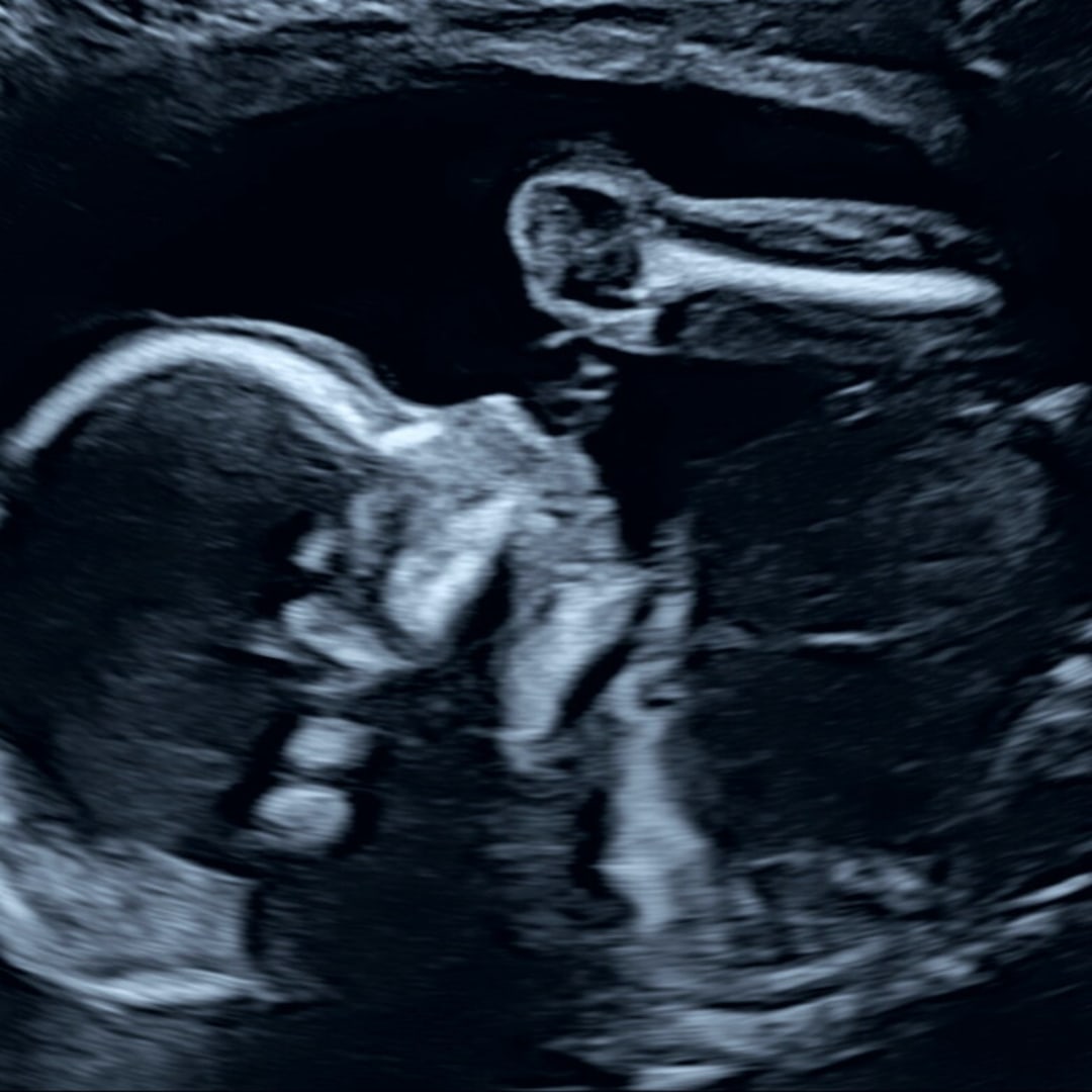 Photo shared by Liz for their Babylist baby registry.