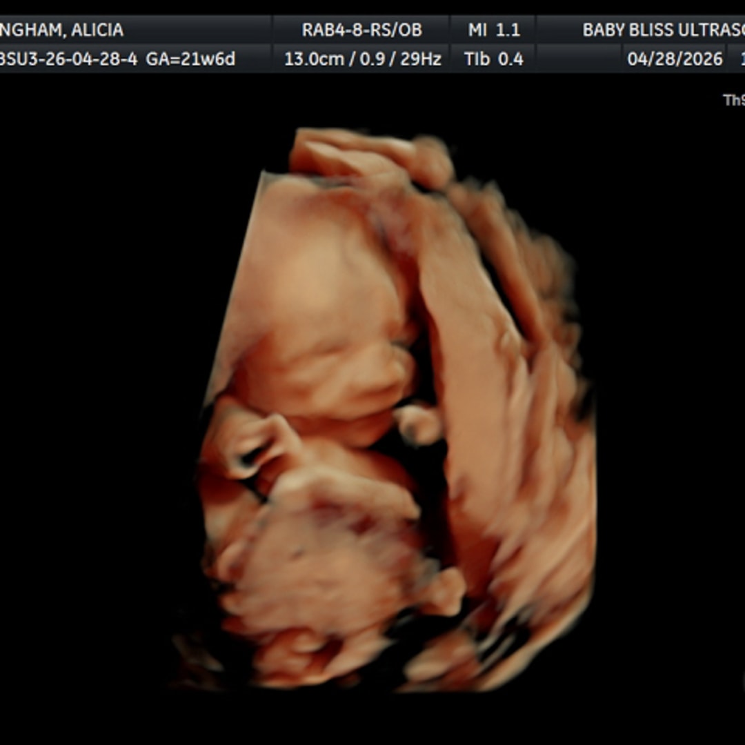 Photo shared by Alicia for their Babylist baby registry.