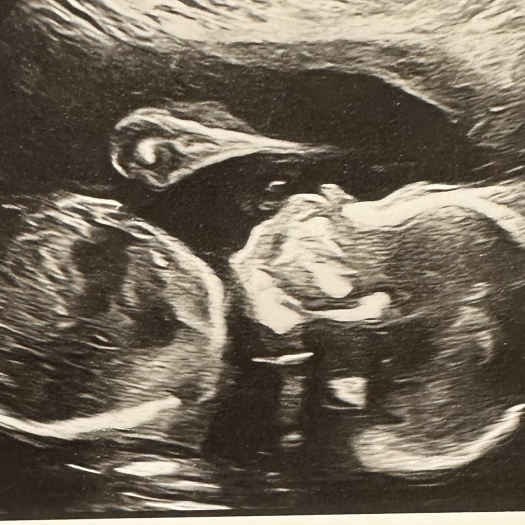 Photo shared by Elizabeth for their Babylist baby registry.