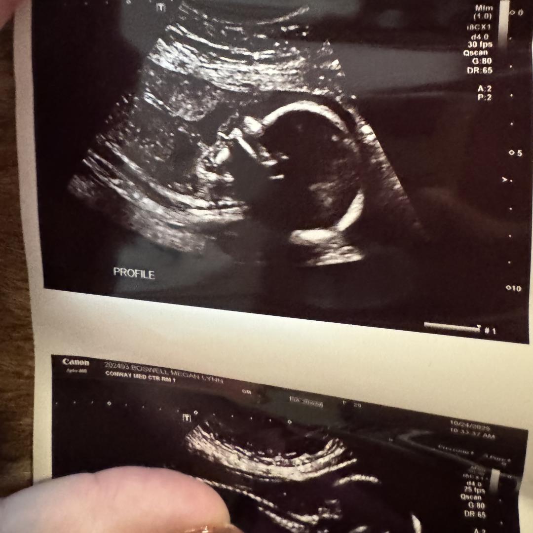 Photo shared by Megan for their Babylist baby registry.