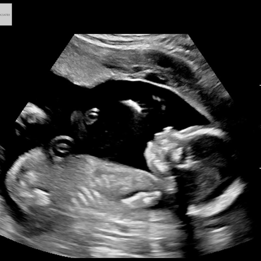 Photo shared by Monica for their Babylist baby registry.