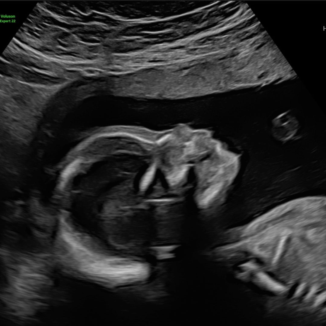 Photo shared by Sonya for their Babylist baby registry.