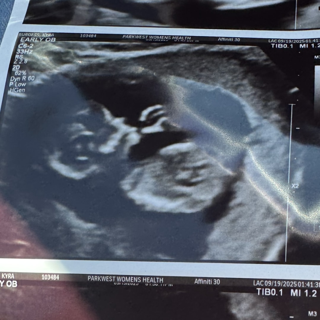 Photo shared by Kay for their Babylist baby registry.