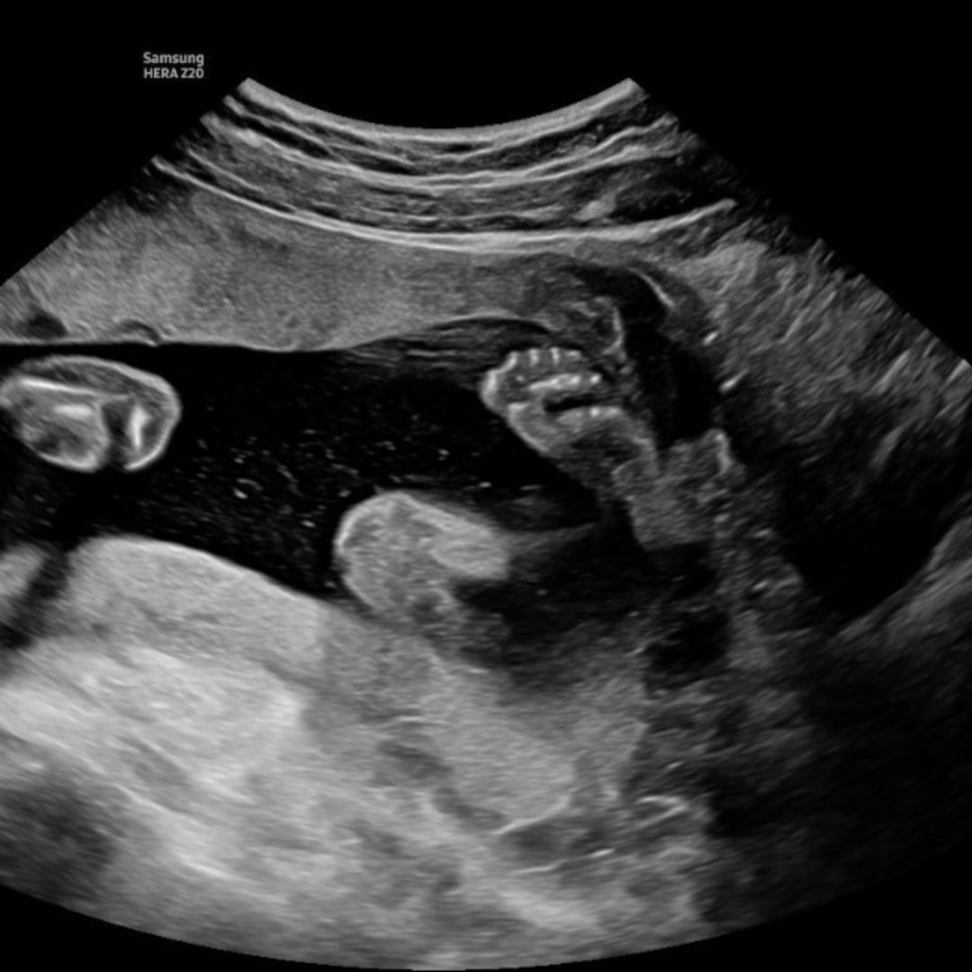 Photo shared by Taylor for their Babylist baby registry.