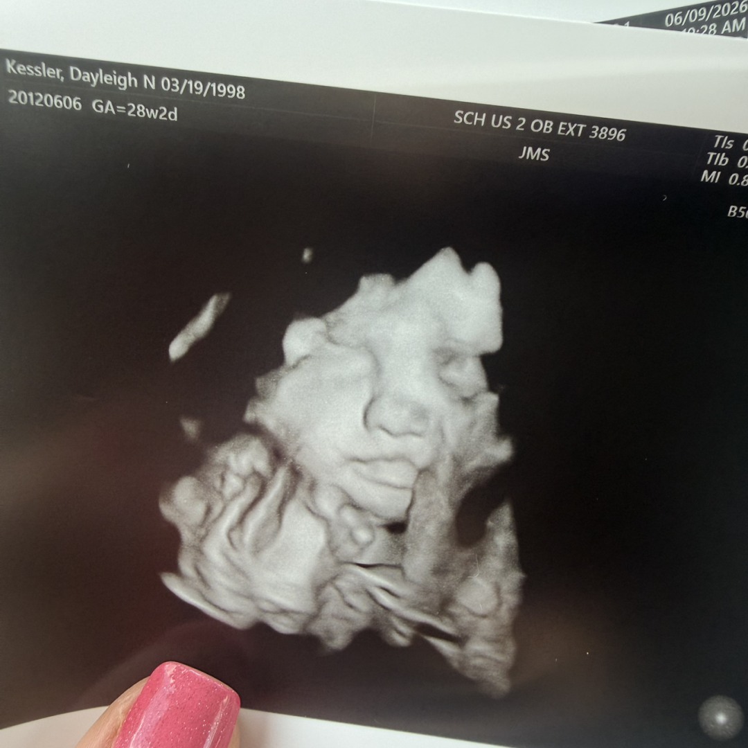 Photo shared by Dayleigh for their Babylist baby registry.