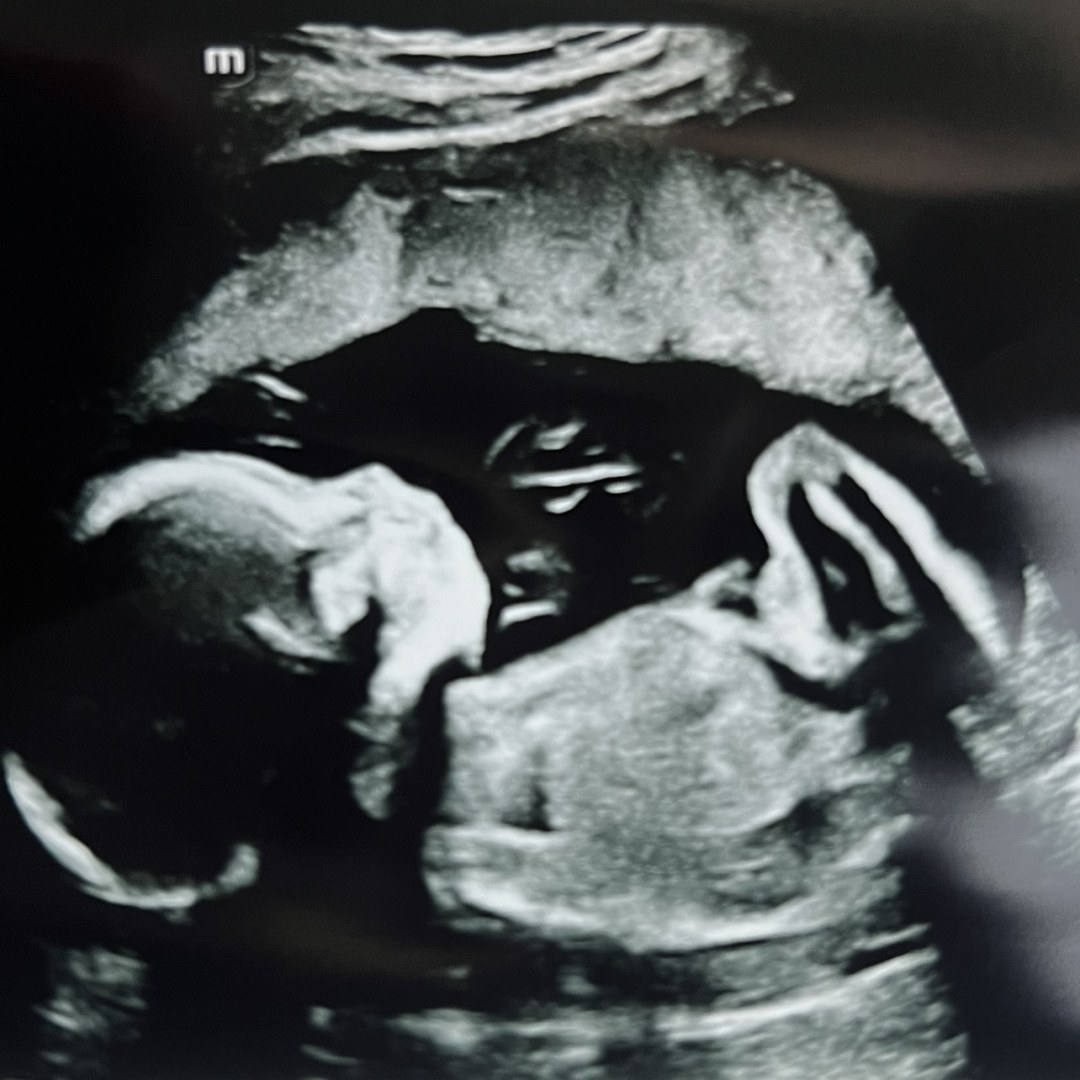 Photo shared by Brooke for their Babylist baby registry.