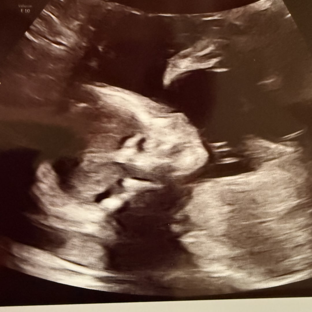 Photo shared by Sabrina for their Babylist baby registry.