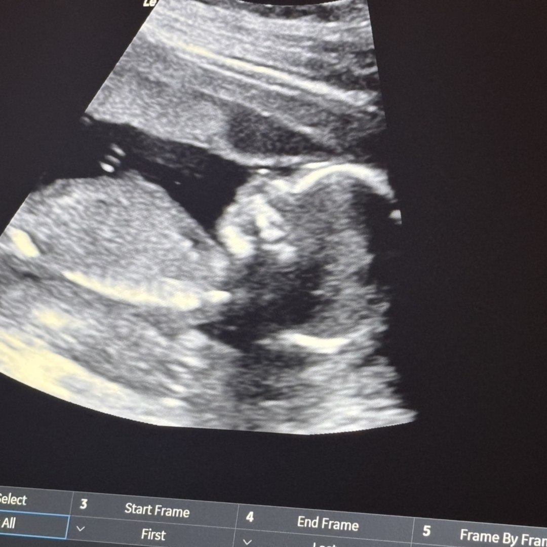 Photo shared by Aliyha for their Babylist baby registry.