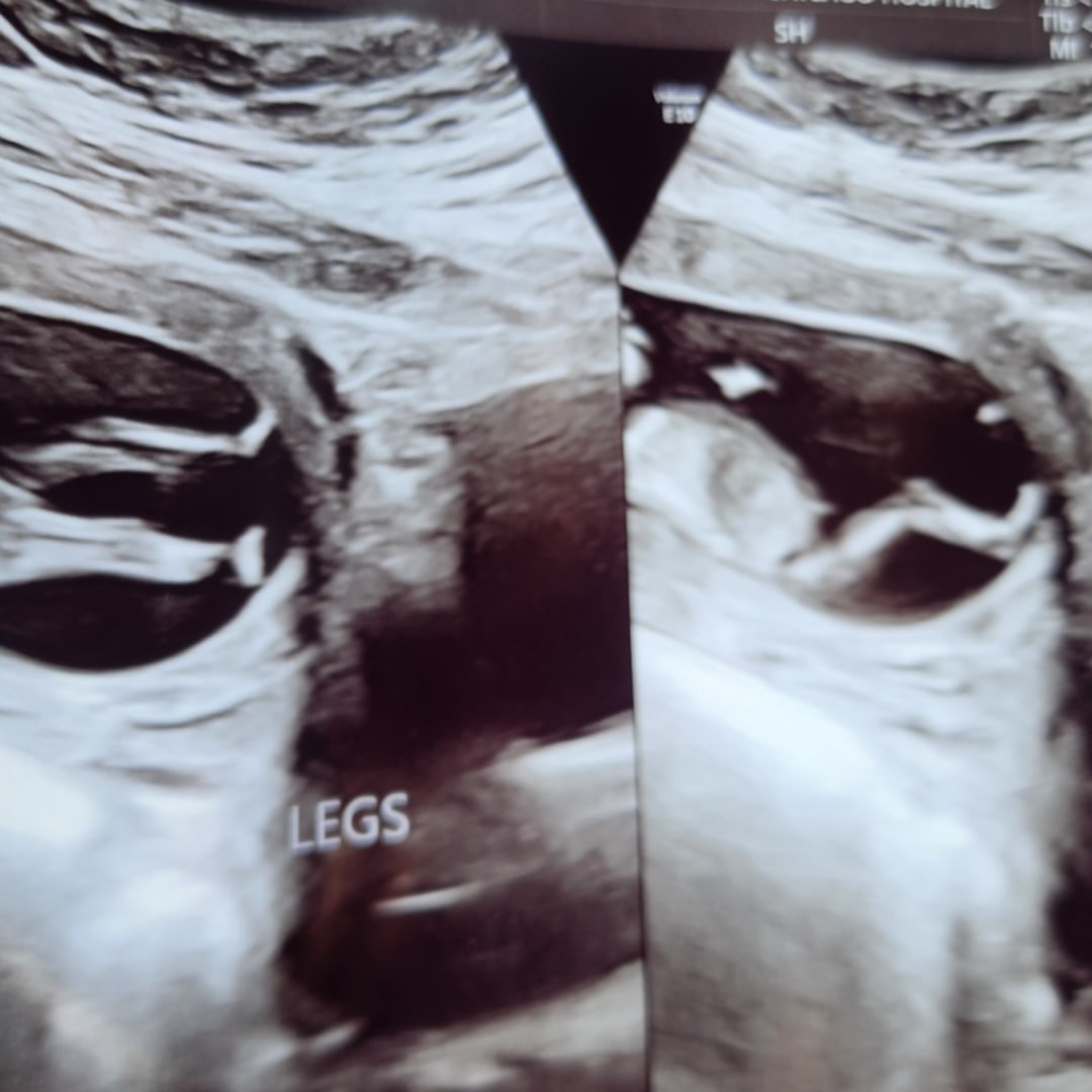 Photo shared by Monica for their Babylist baby registry.
