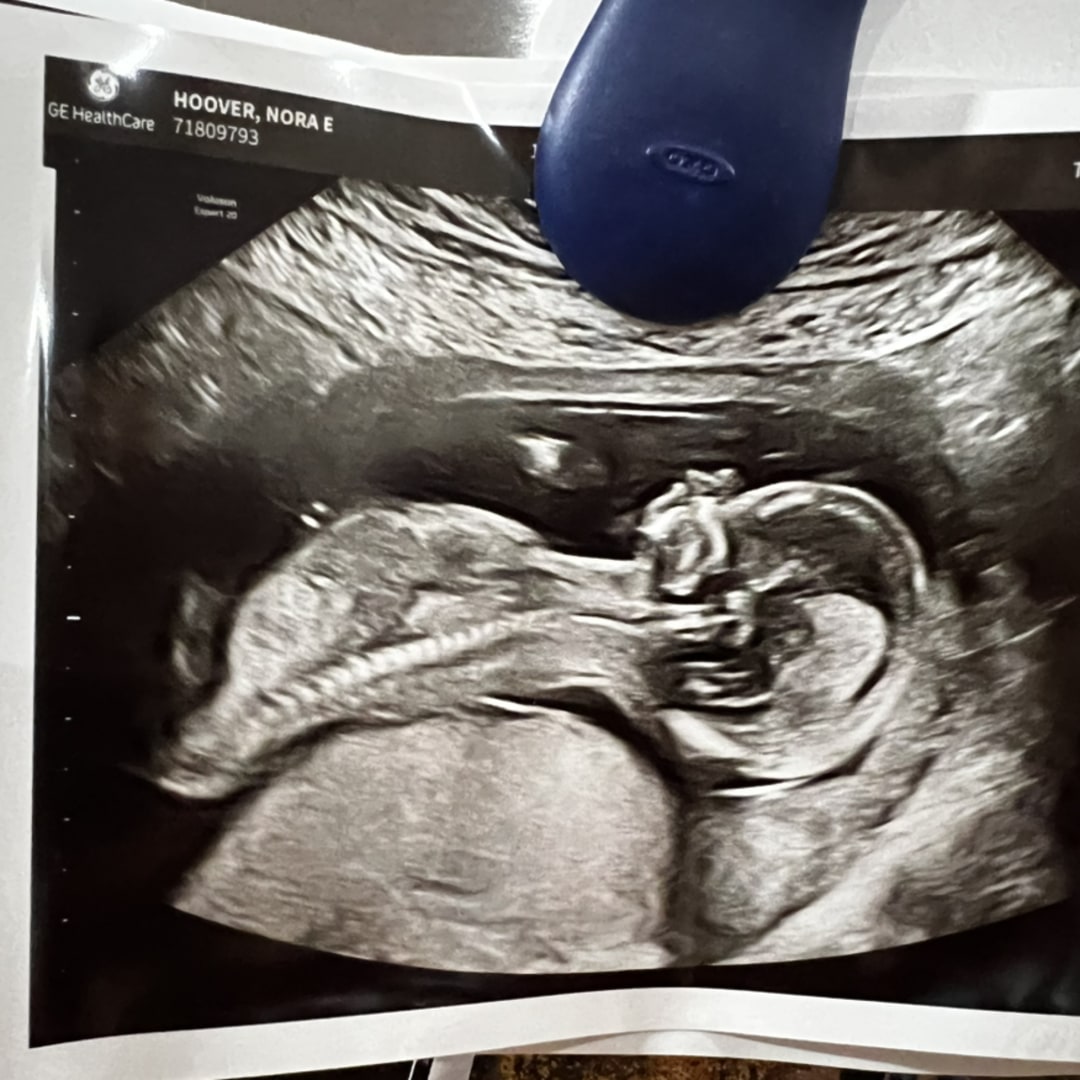Photo shared by Nora for their Babylist baby registry.