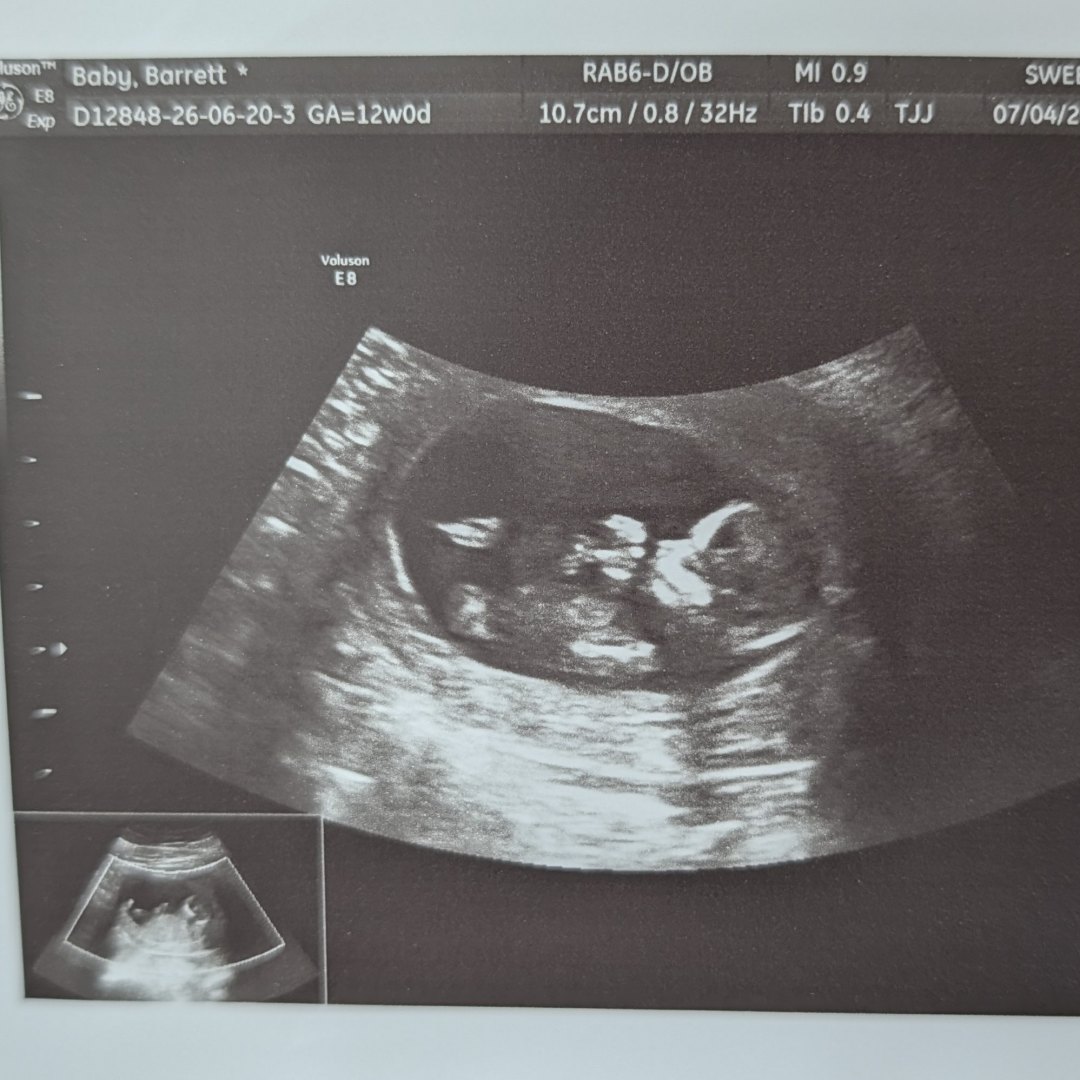 Photo shared by Megan for their Babylist baby registry.