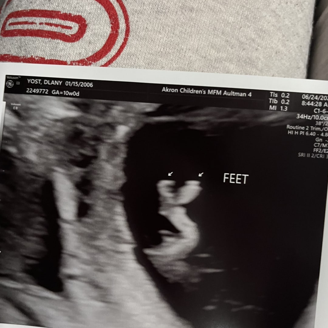 Photo shared by D’Lany for their Babylist baby registry.