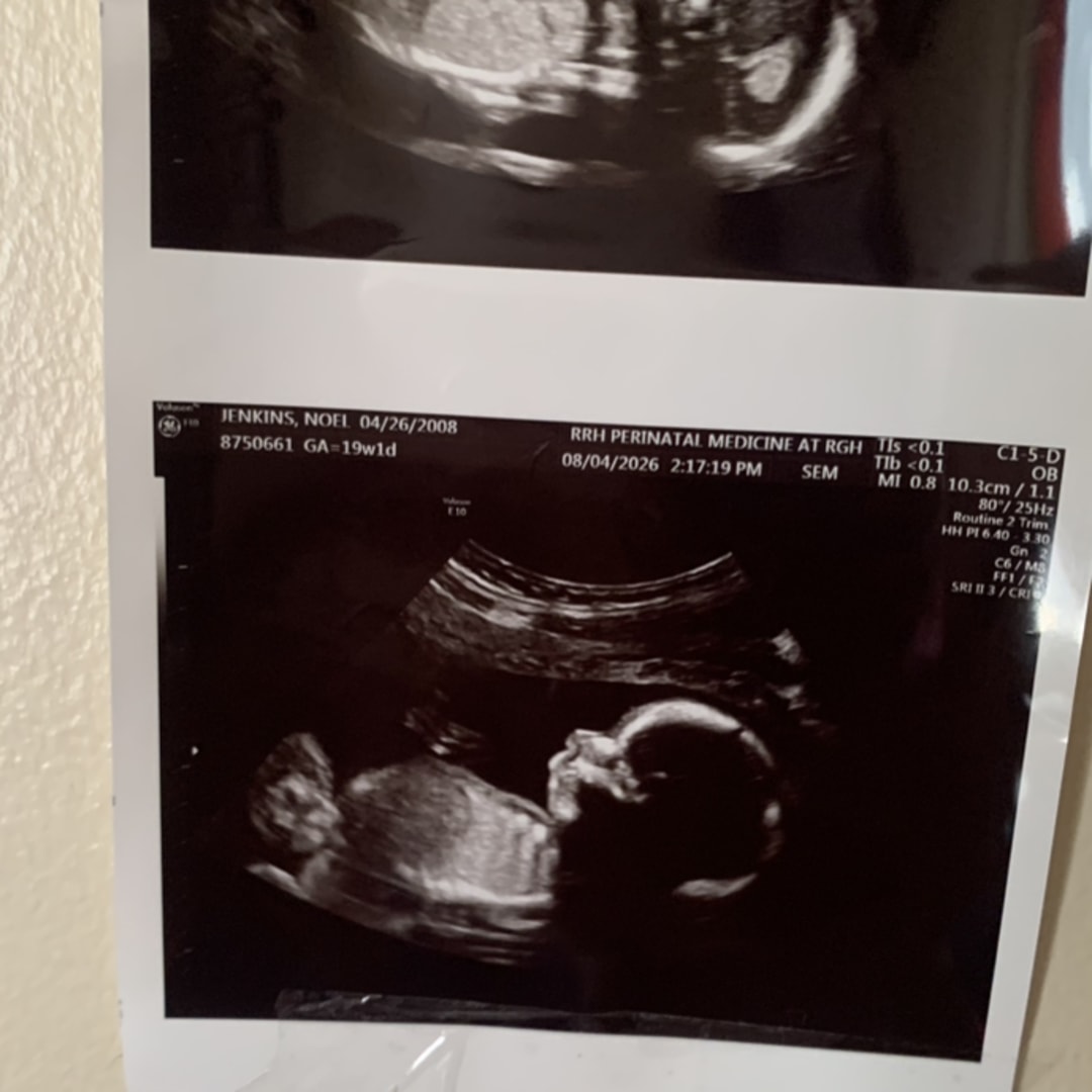 Photo shared by Noel for their Babylist baby registry.