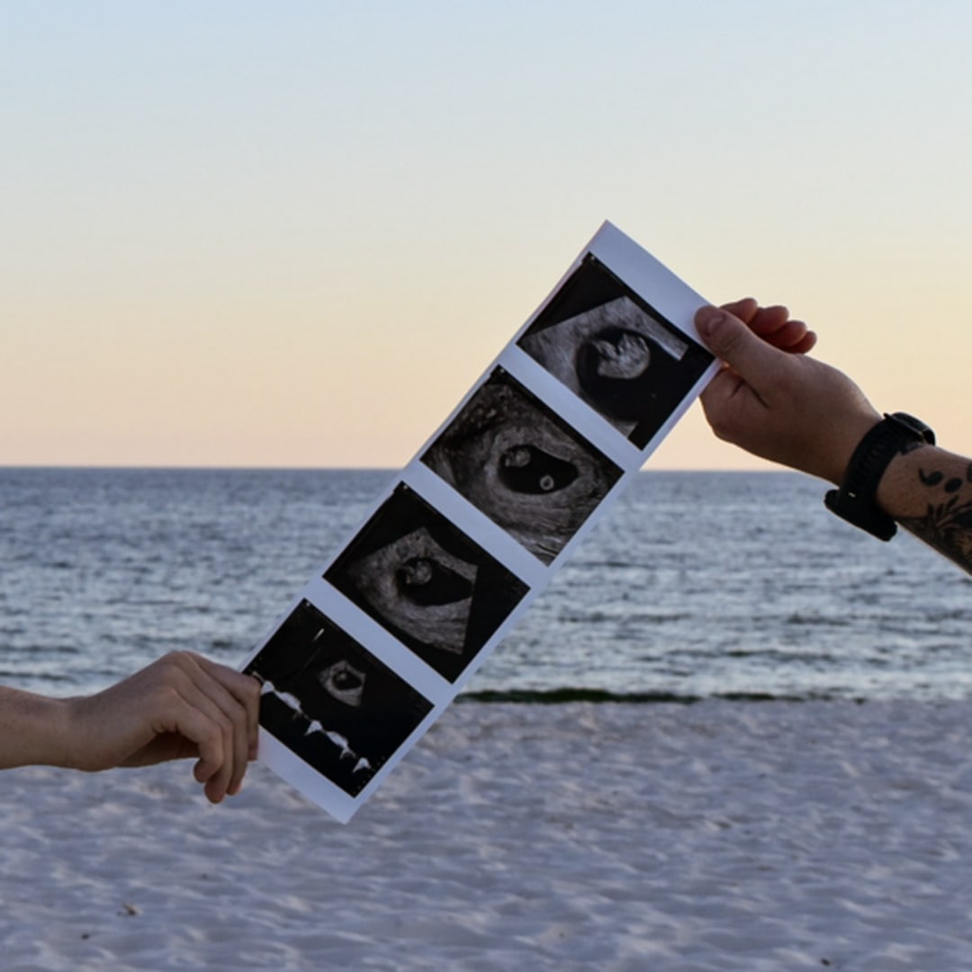 Photo shared by Lauren for their Babylist baby registry.