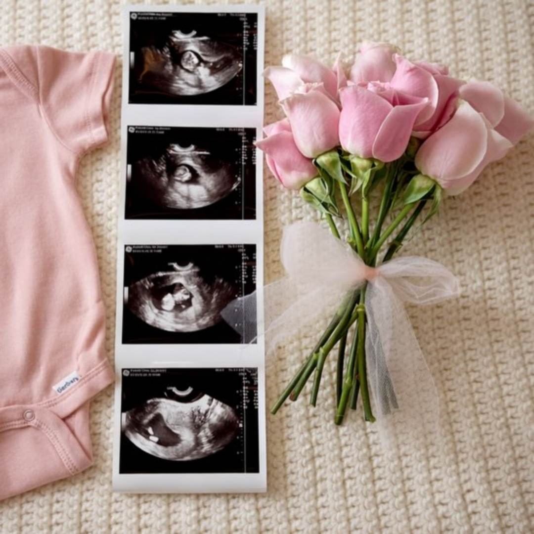 Photo shared by Autumn for their Babylist baby registry.