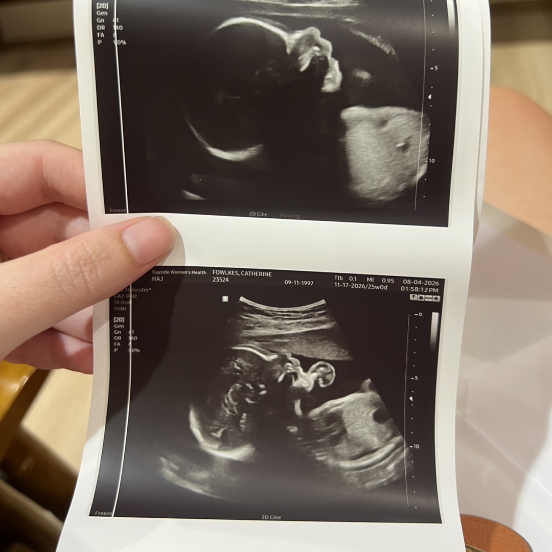 Photo shared by Catherine for their Babylist baby registry.