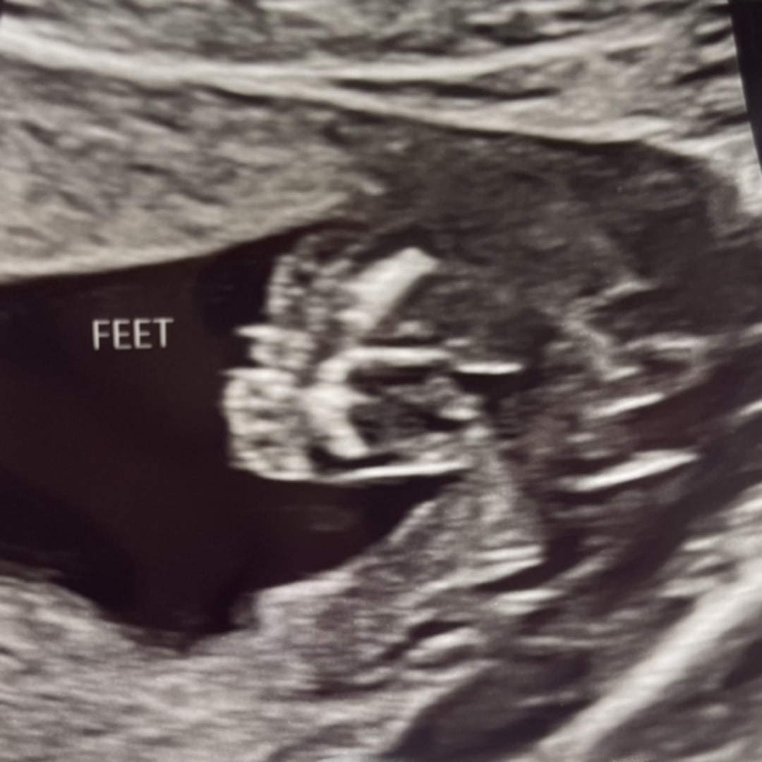 Photo shared by Jaslyn for their Babylist baby registry.