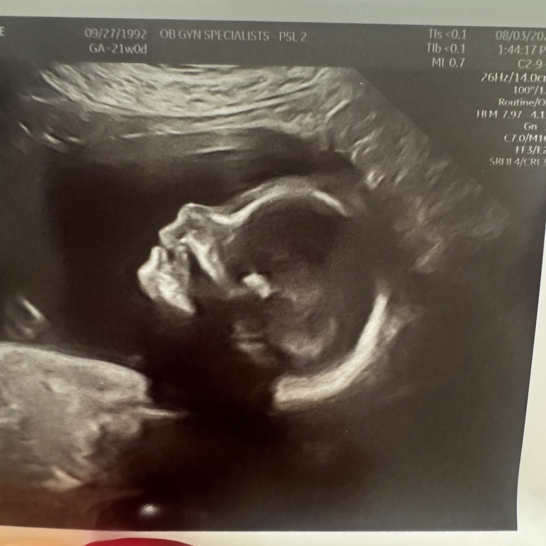 Photo shared by DonnaMarie for their Babylist baby registry.
