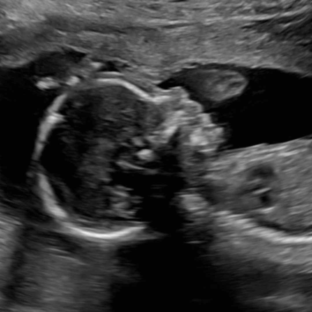 Photo shared by Julie for their Babylist baby registry.