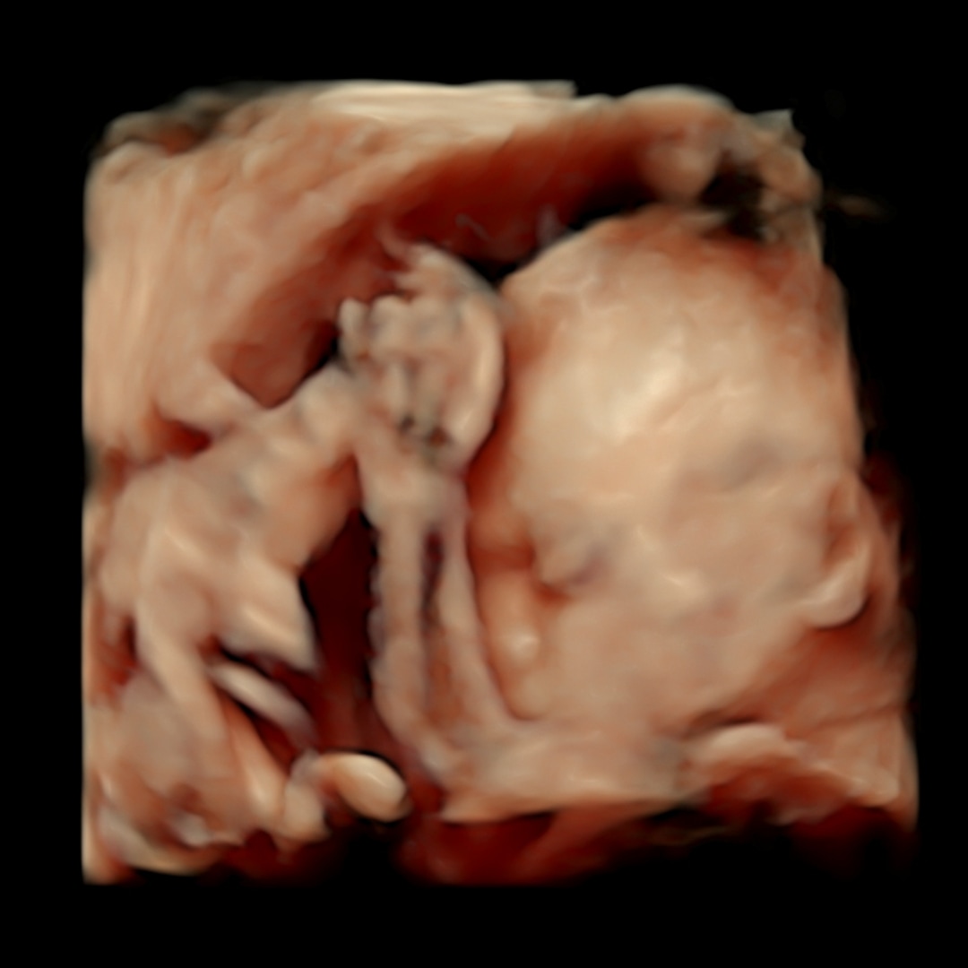 Photo shared by Kaitlin for their Babylist baby registry.