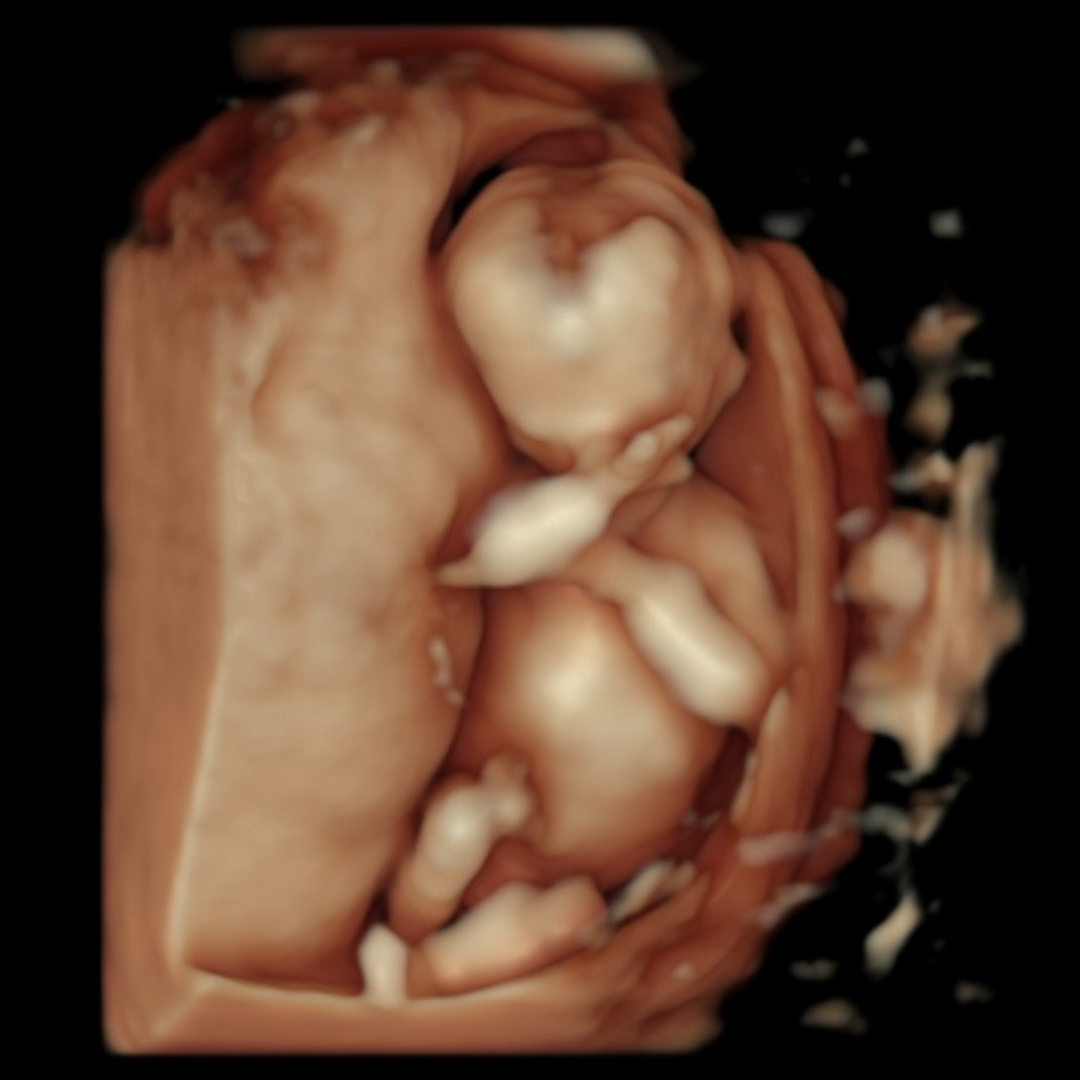 Photo shared by Brooke for their Babylist baby registry.