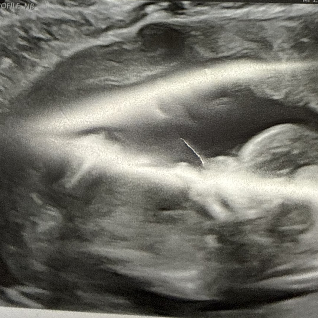 Photo shared by Simone for their Babylist baby registry.