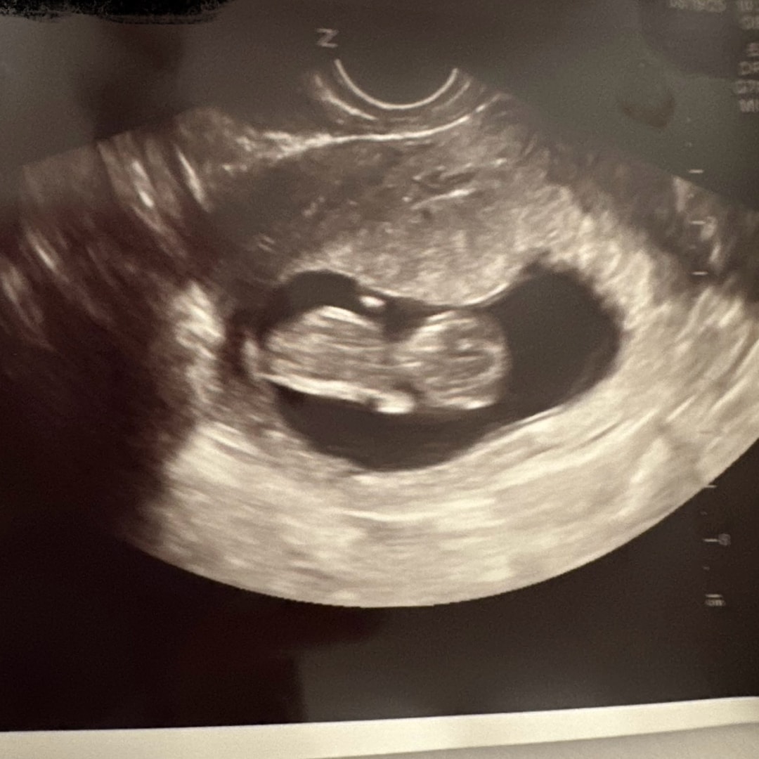 Photo shared by Alexis for their Babylist baby registry.