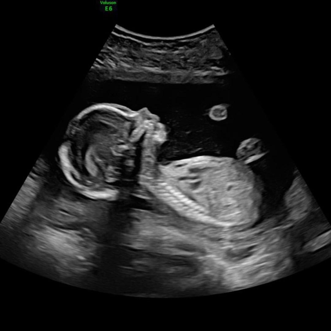 Photo shared by Gracie for their Babylist baby registry.