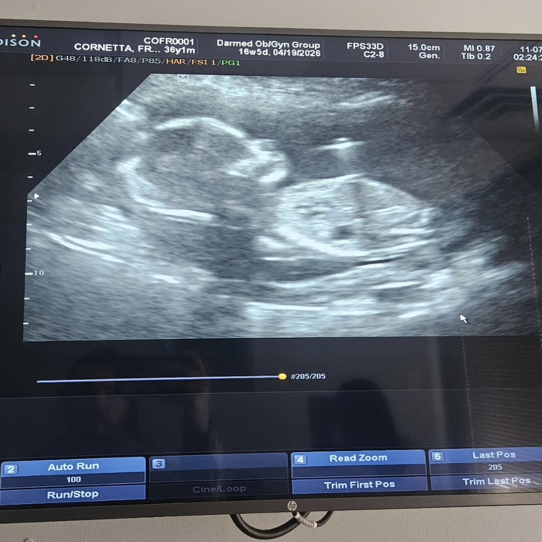 Photo shared by Fran for their Babylist baby registry.