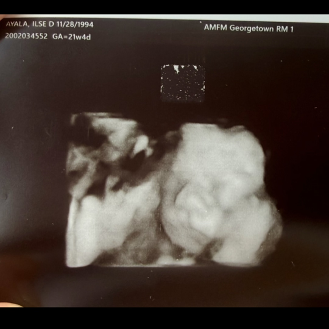 Photo shared by Ilse for their Babylist baby registry.
