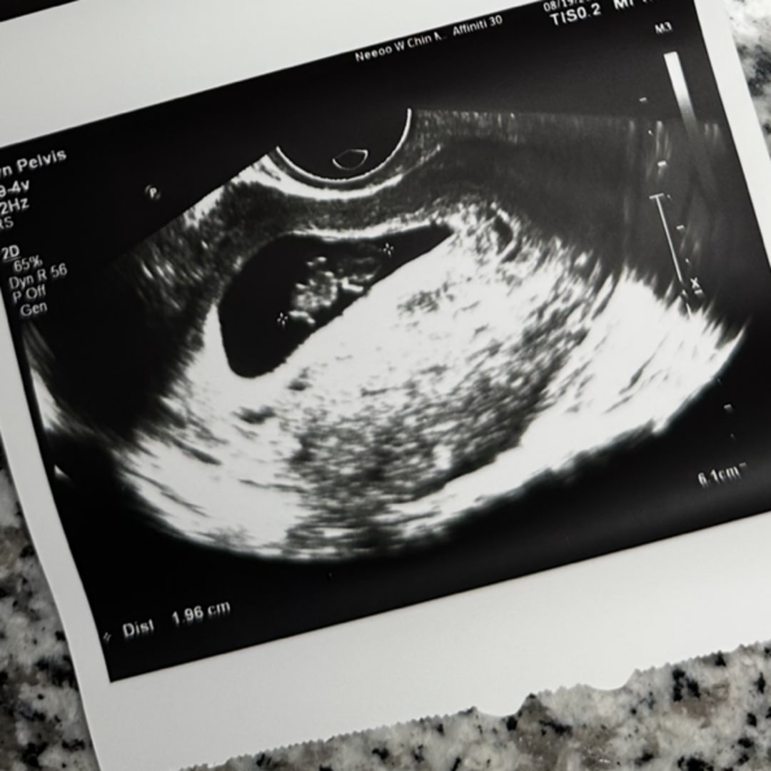 Photo shared by Katie for their Babylist baby registry.