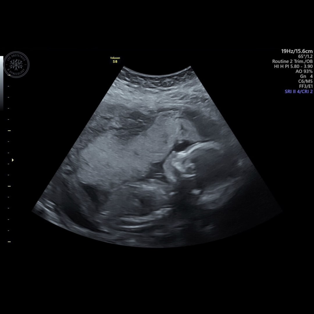 Photo shared by Morgan for their Babylist baby registry.