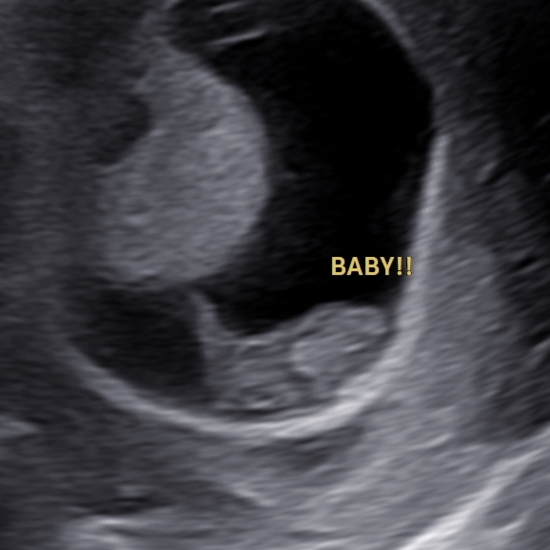 Photo shared by Amber for their Babylist baby registry.