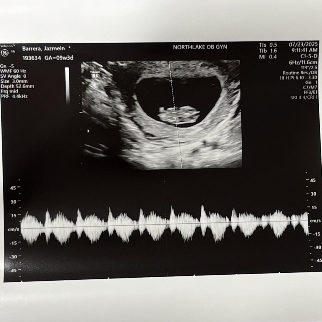 Photo shared by Jazmein for their Babylist baby registry.