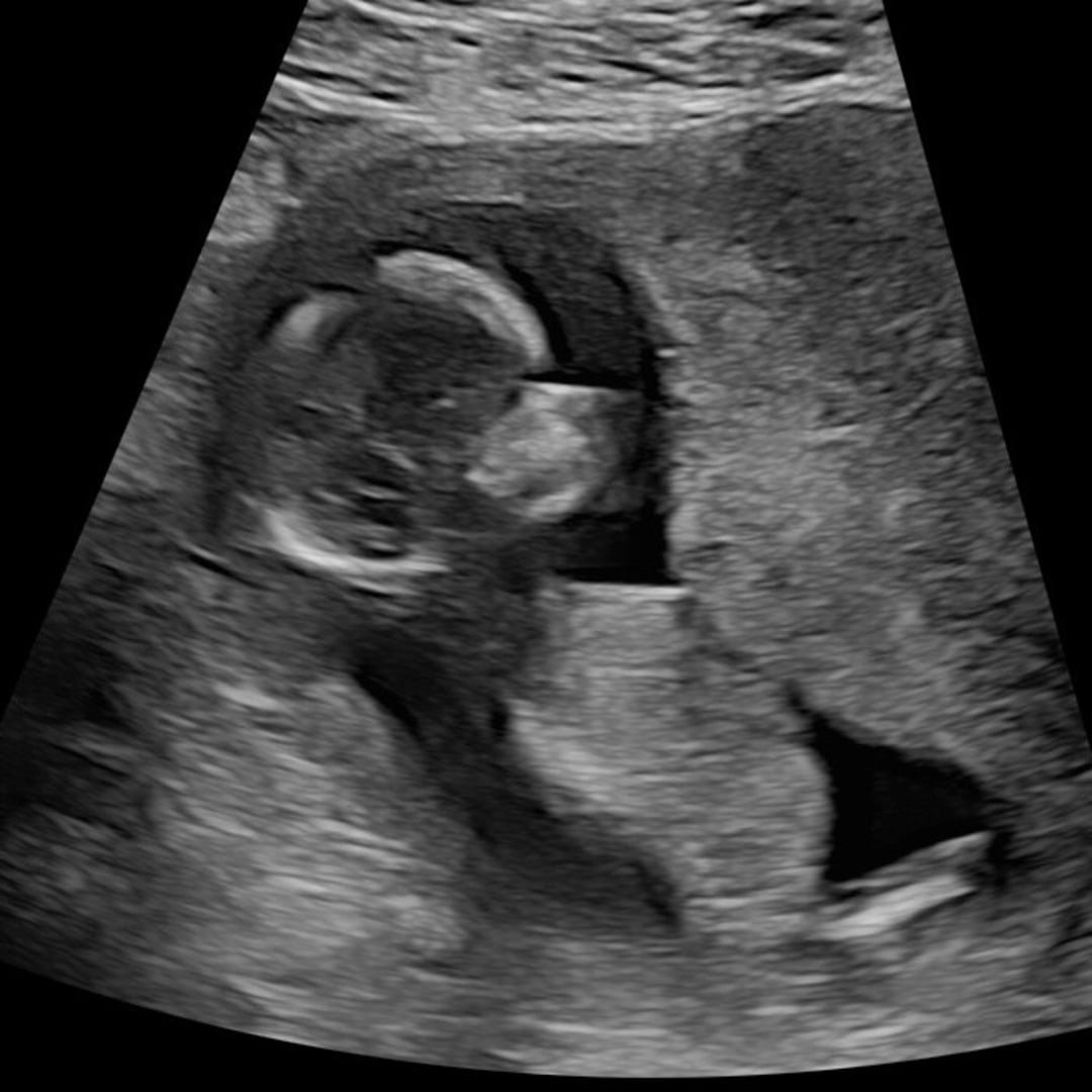 Photo shared by Gabrielle for their Babylist baby registry.