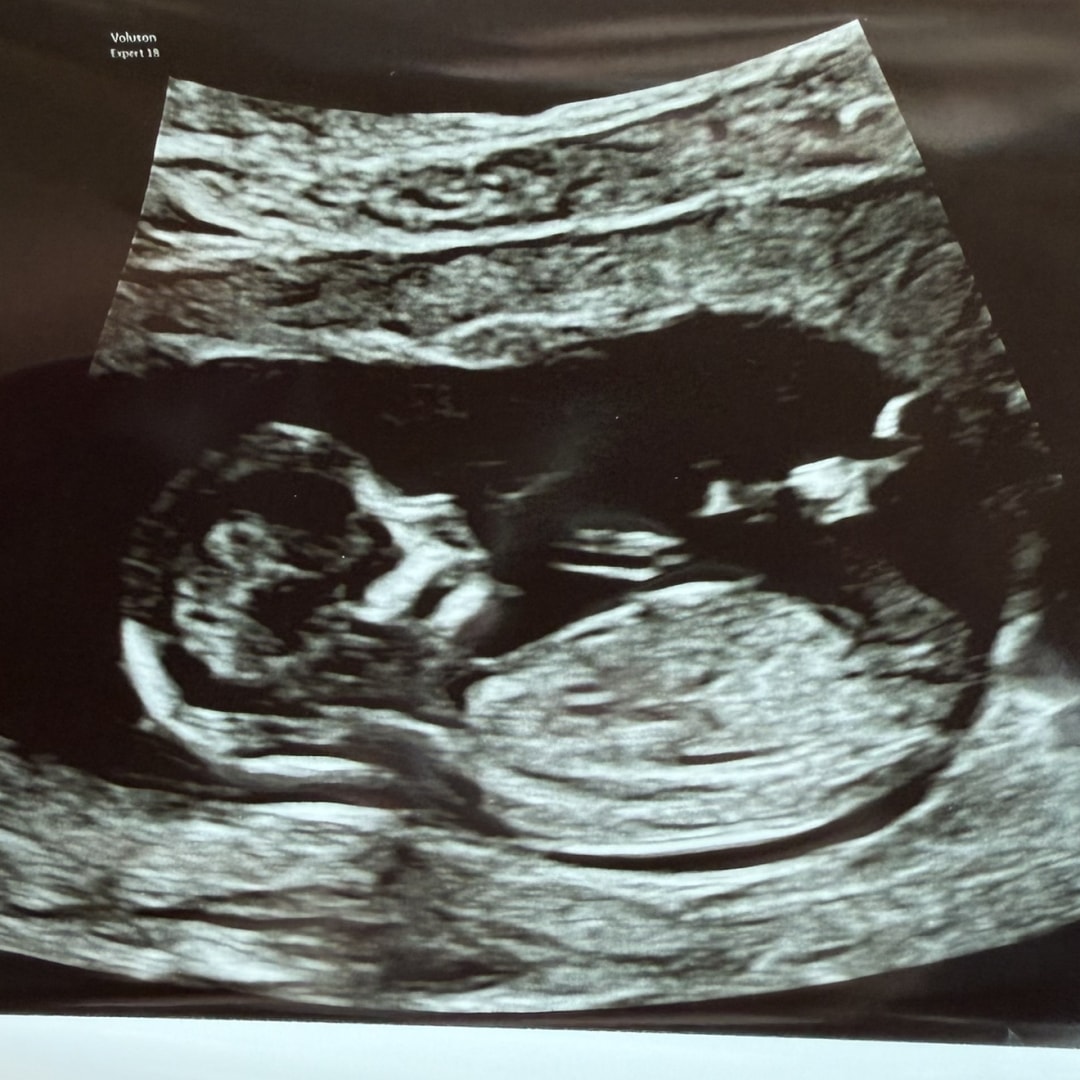 Photo shared by Lydia for their Babylist baby registry.