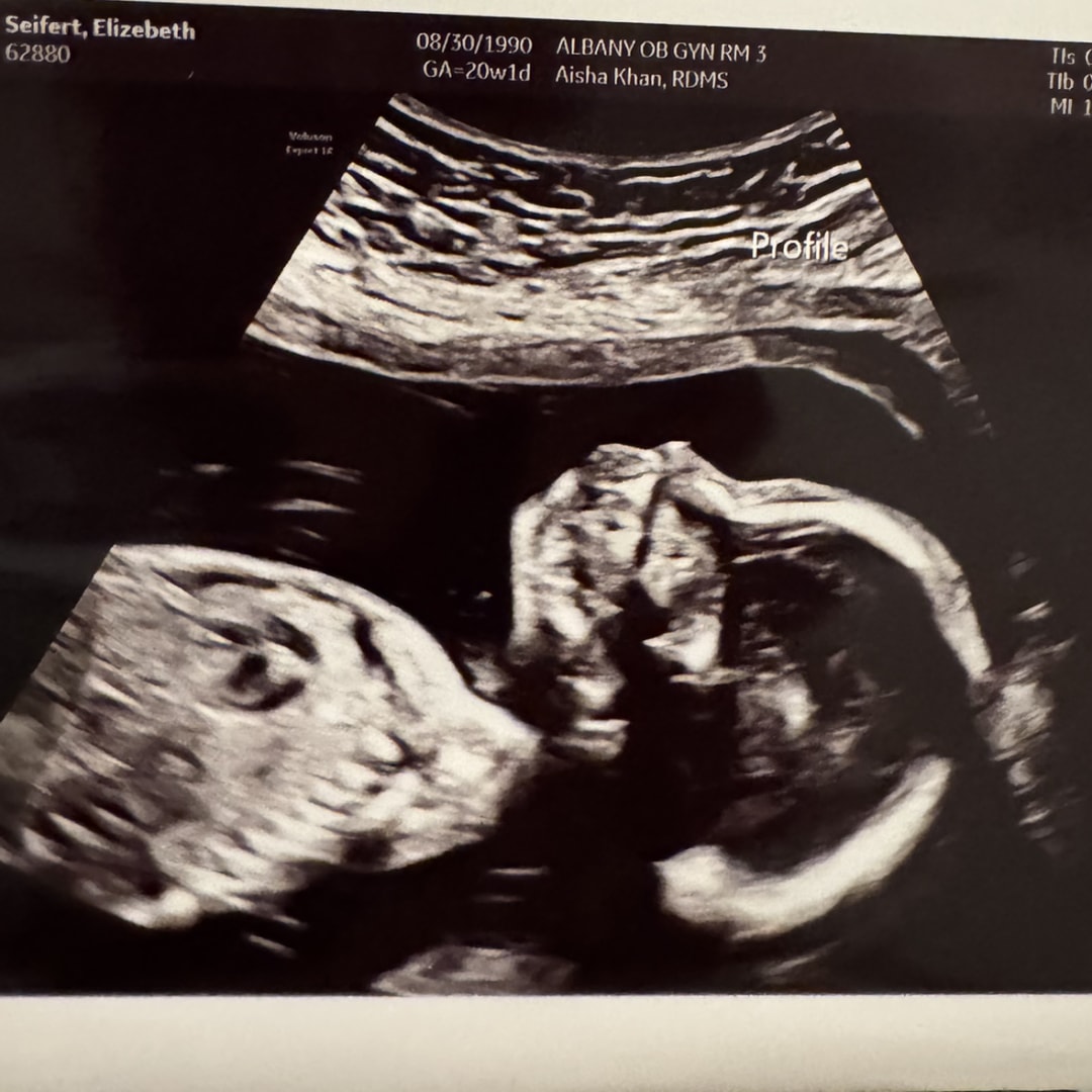 Photo shared by Elizabeth for their Babylist baby registry.