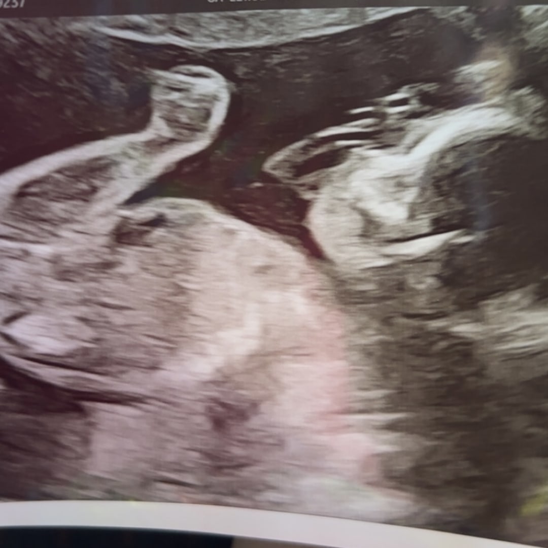 Photo shared by Melanie for their Babylist baby registry.