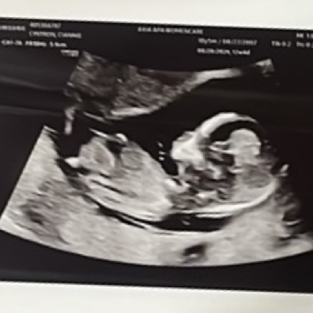 Photo shared by Ciannie for their Babylist baby registry.