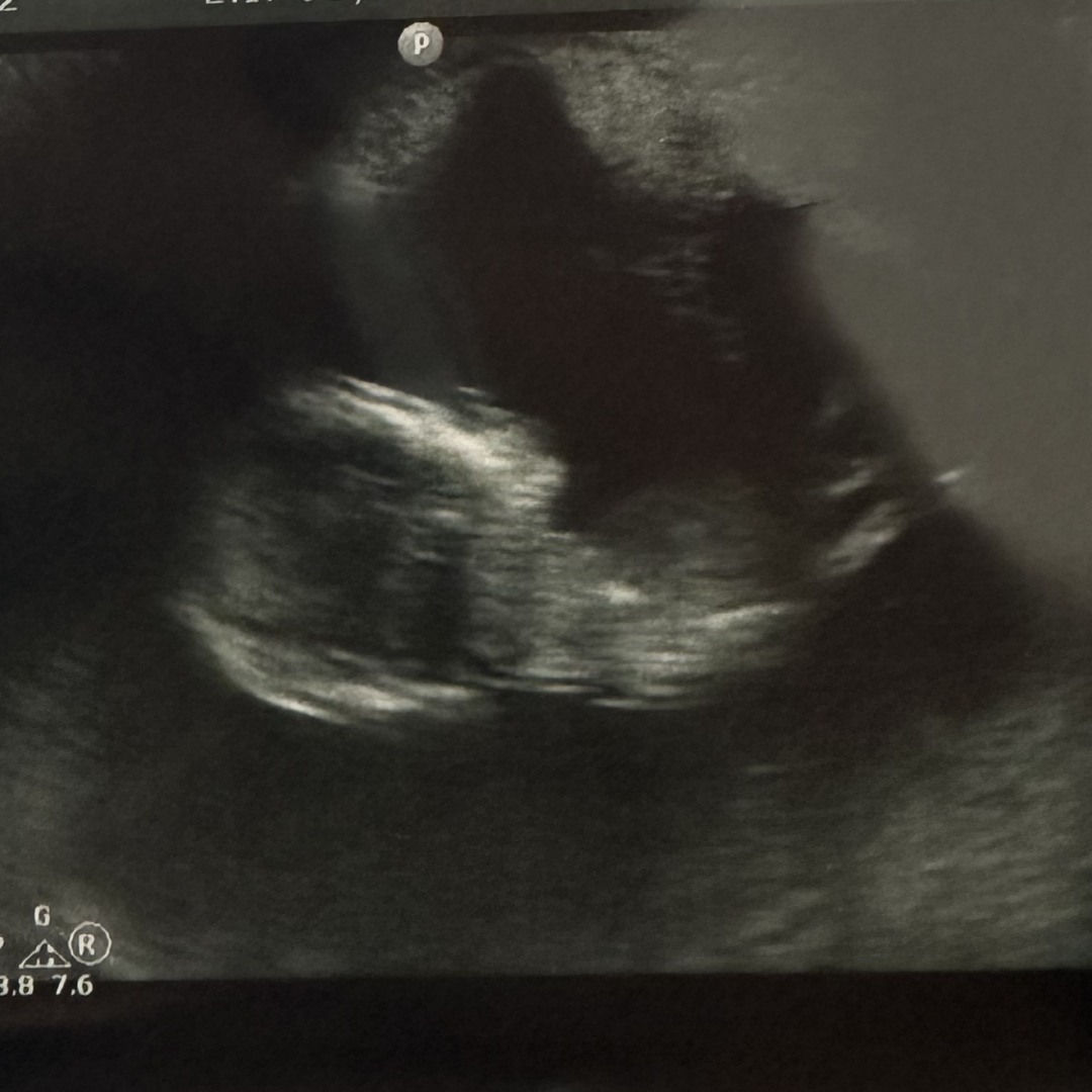 Photo shared by Kaitlyn for their Babylist baby registry.