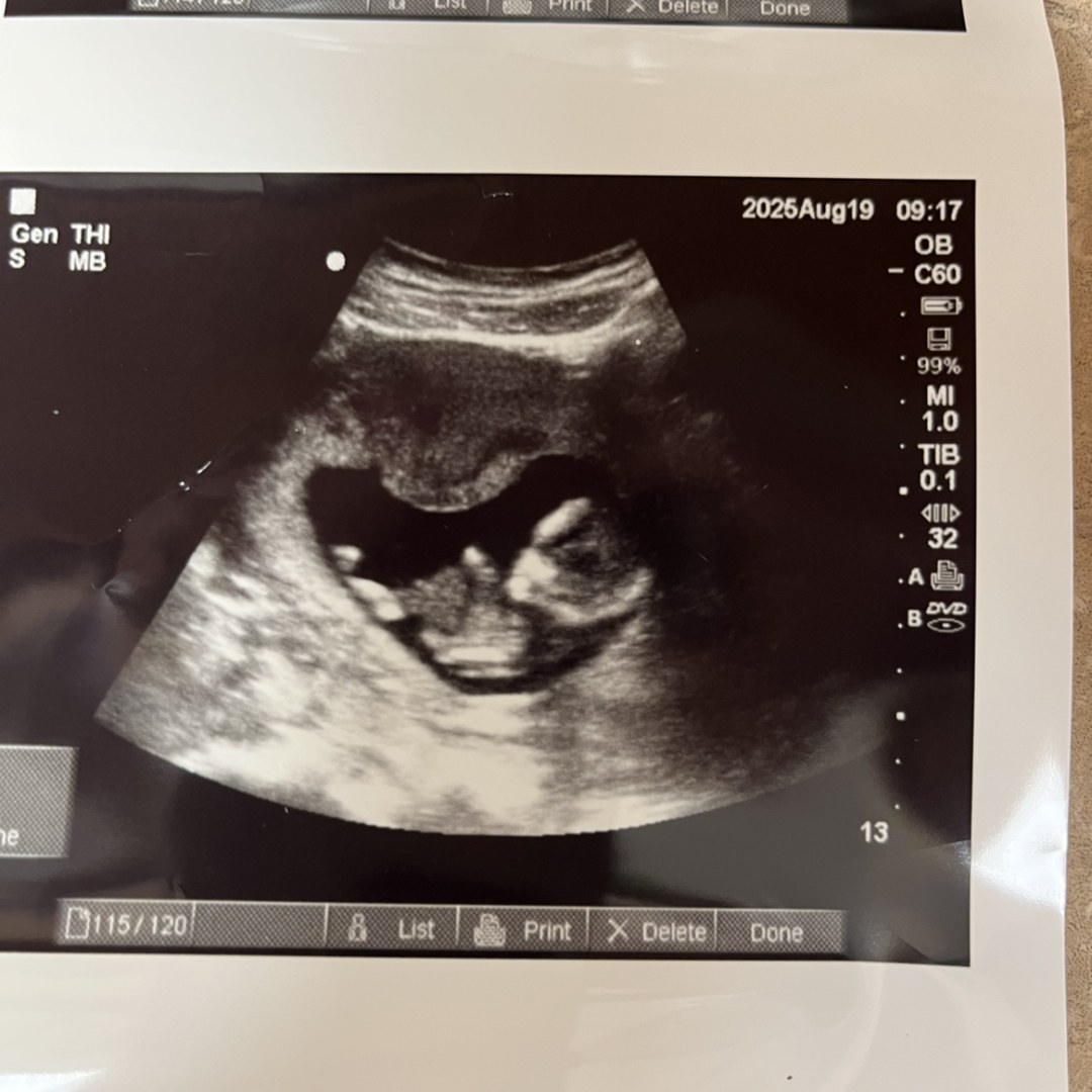 Photo shared by Brooklyn for their Babylist baby registry.