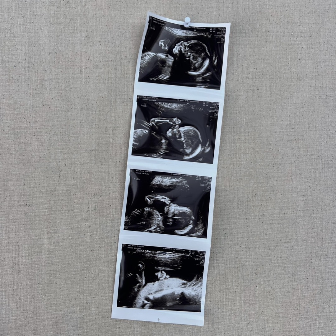 Photo shared by Grace for their Babylist baby registry.